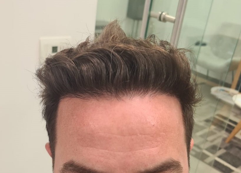 8. After Front.jpg