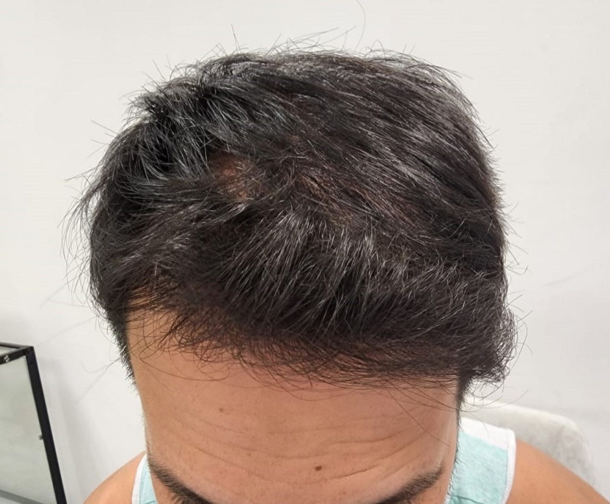 8. After Front.jpg
