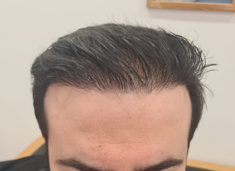 8. After Front - Wed look.jpg
