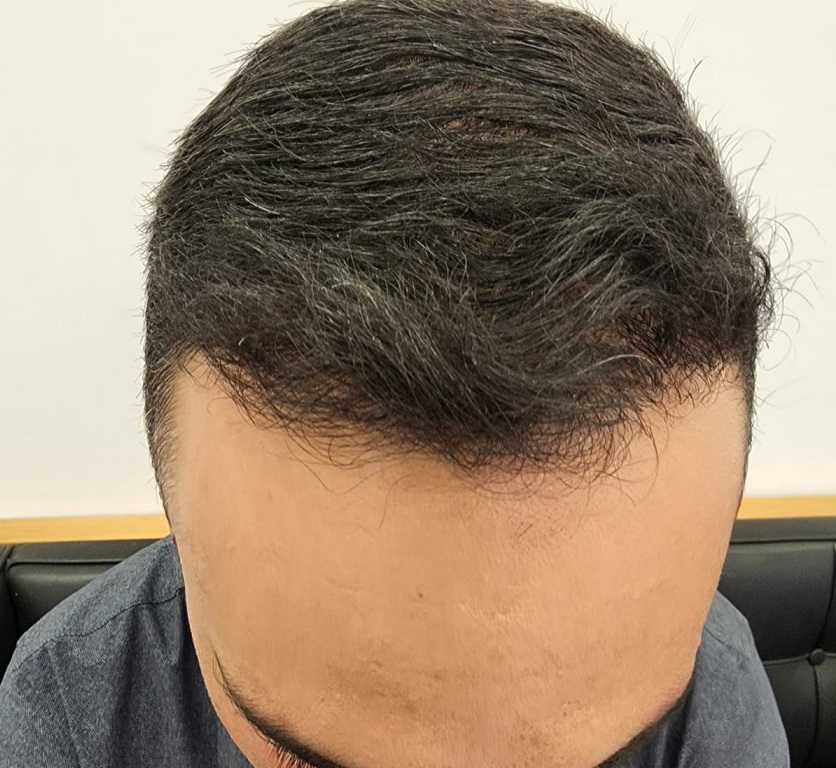 8. After.jpg