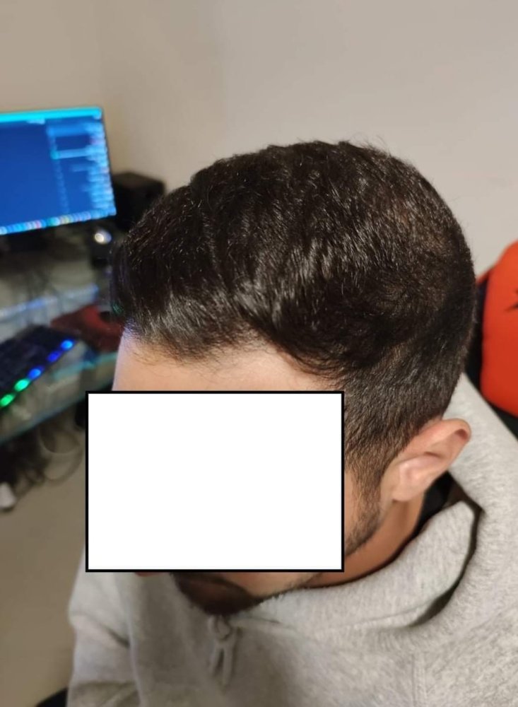 8. After left.jpg