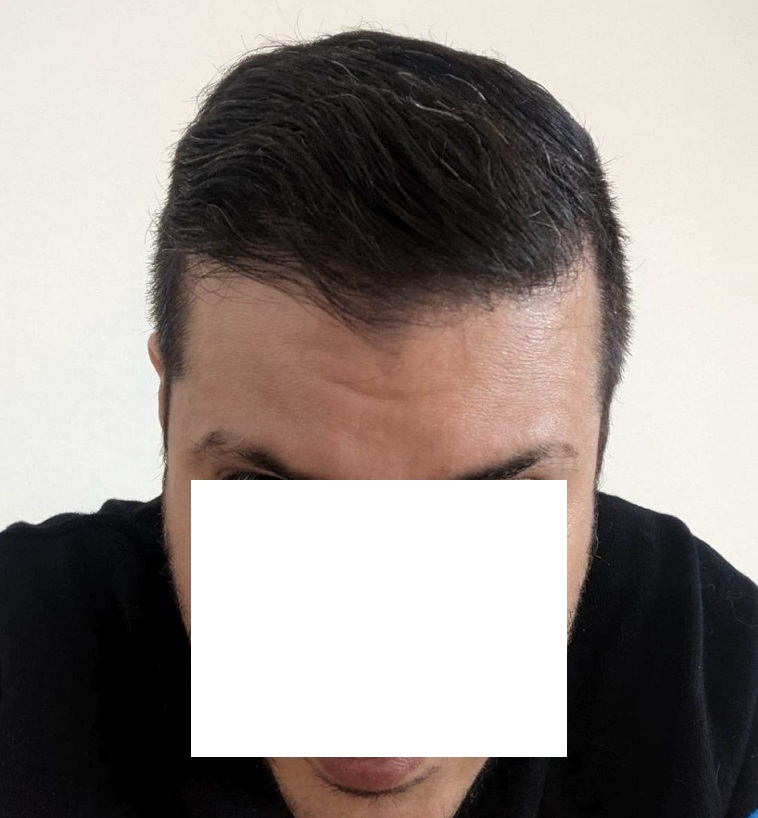 8. After with Face - Front.jpg