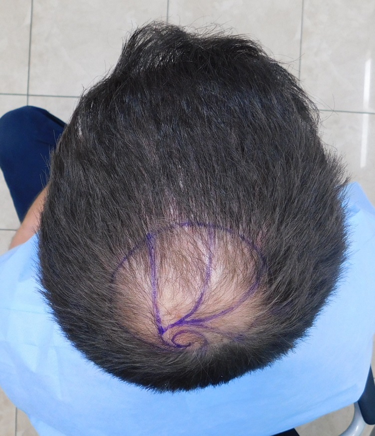 8. Crown with Top View.JPG