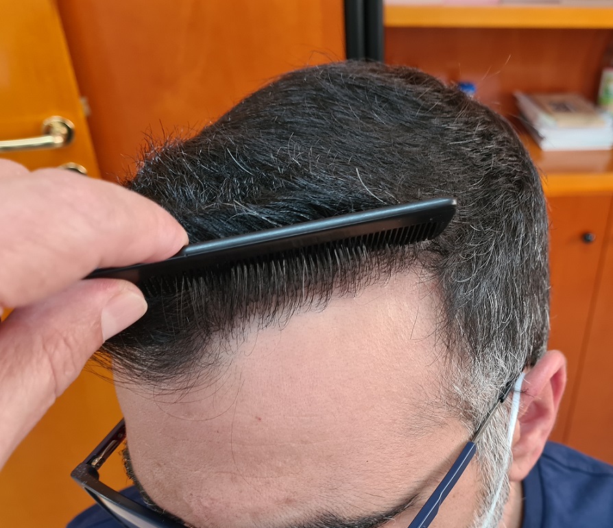 8. Front Hairilne left.jpg