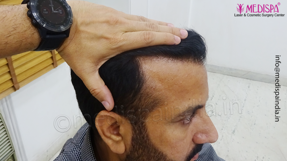 8.png