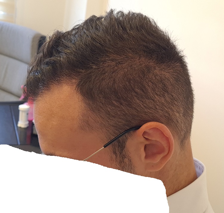 9. 10 months left side View.jpg