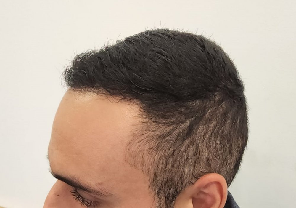 9. After left side.jpg