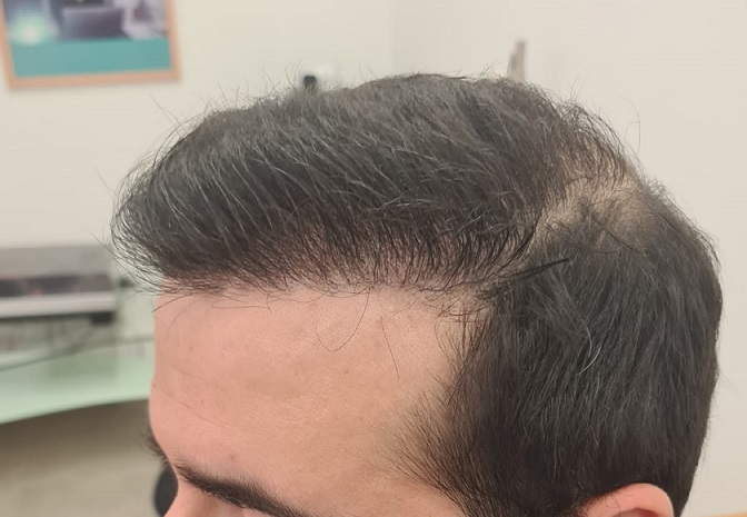 9. After Left - wed look.jpg