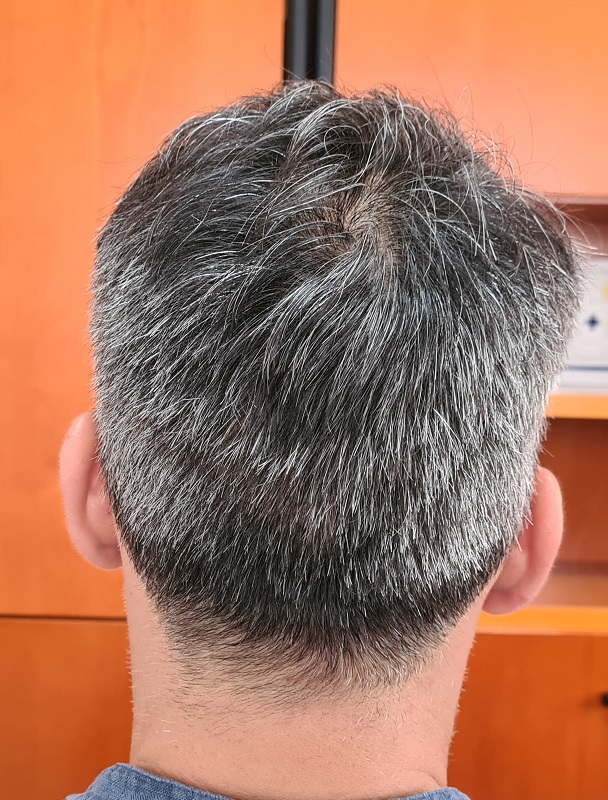 9. donor back side.jpg