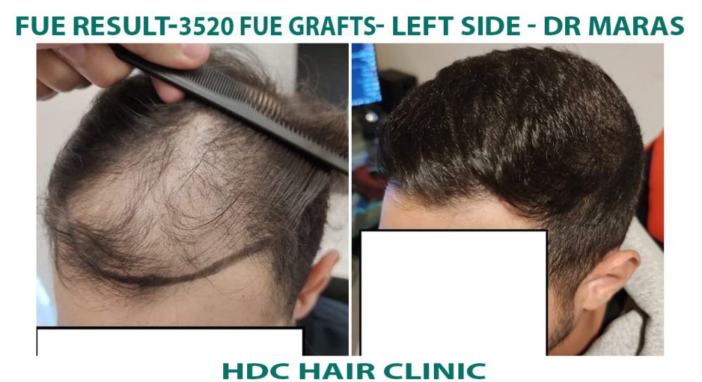 9.  Left Side set 3520.jpg