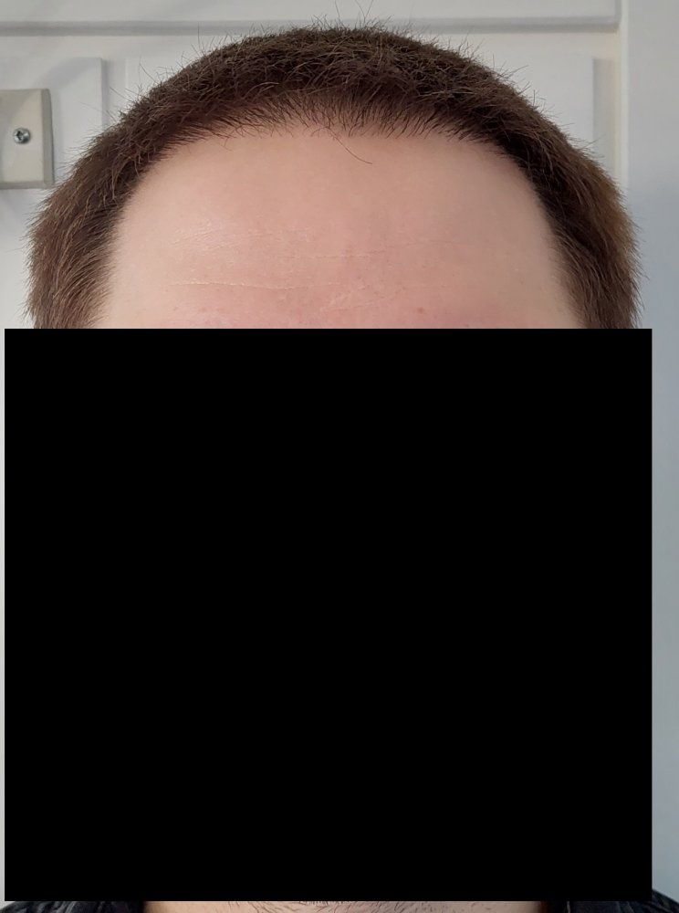 _Before (1).jpg