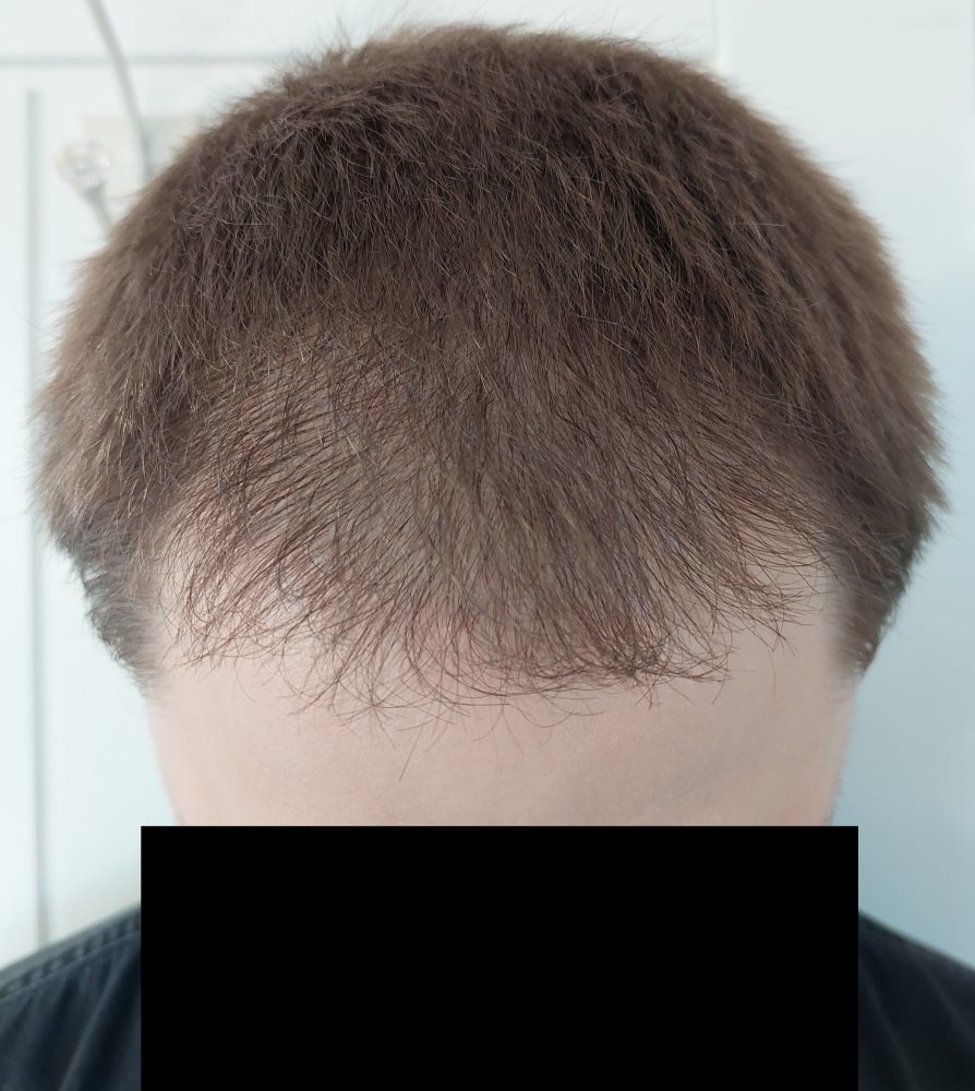 _Before (2).jpg