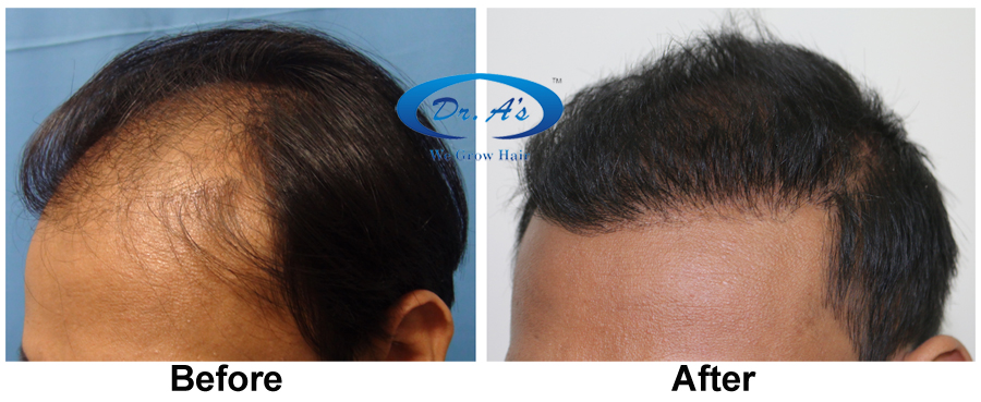 A comparison picture 226_49.jpg