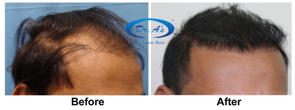 A comparison picture 330_46.jpg