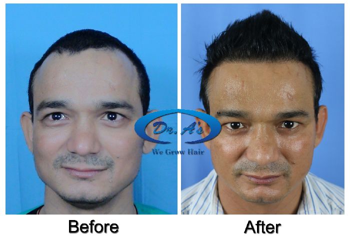 A comparison picture10_31.jpg