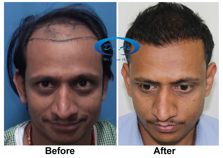 A comparison picture26_21.jpg