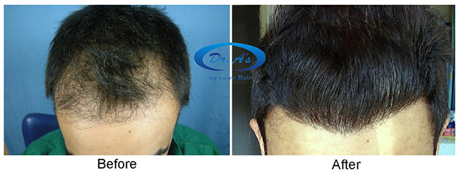 A comparison picture38_55.jpg