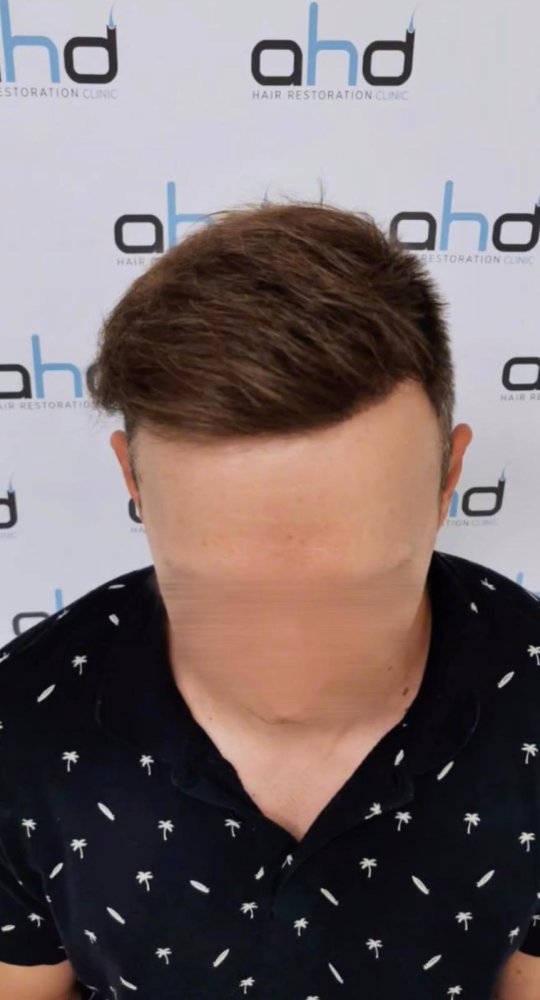 a1.jpeg