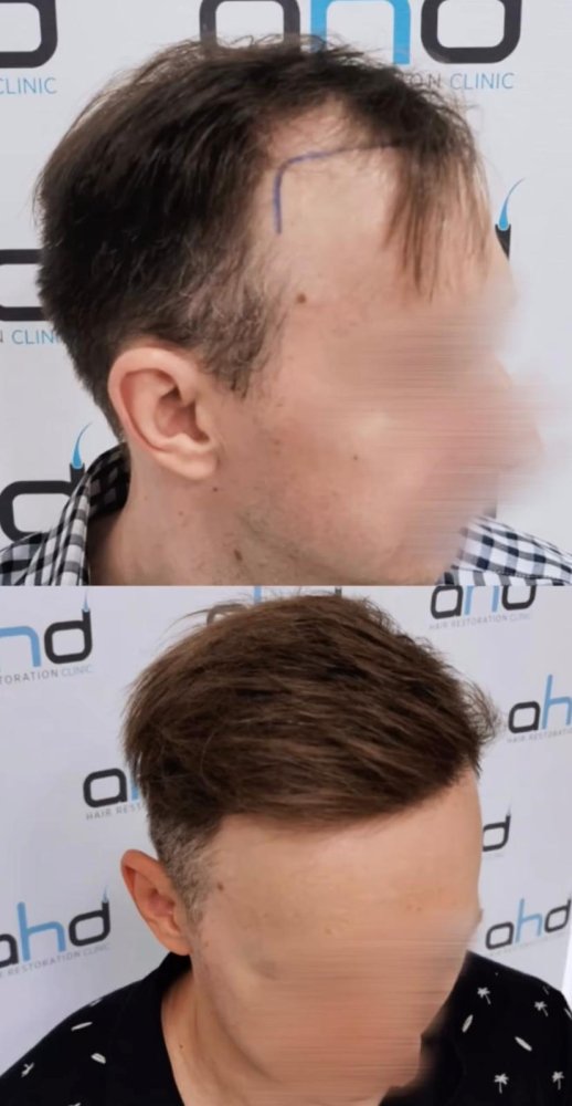 a5.1.jpeg