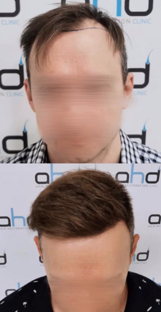 a5.jpeg