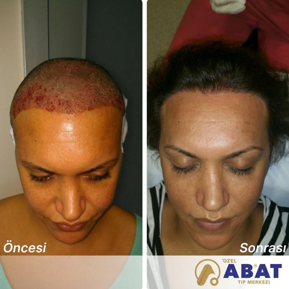 abatinternational_1689230221_3145813564132021005_55170813016.jpg