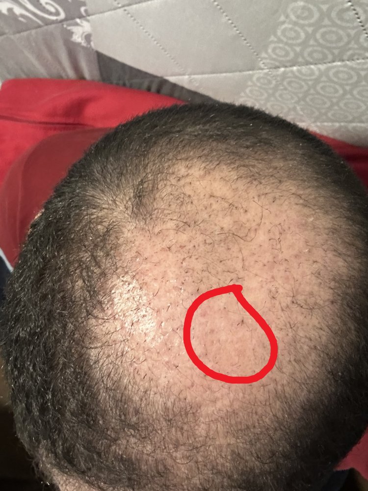 After 8 weeks.jpeg
