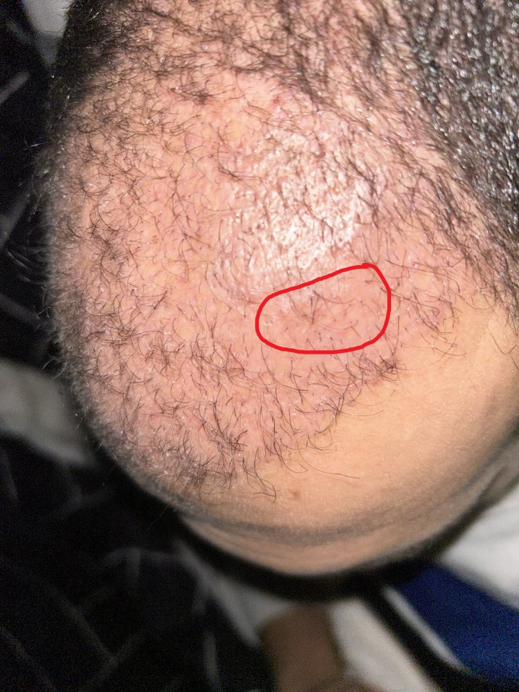 After 8 weeks_.jpeg