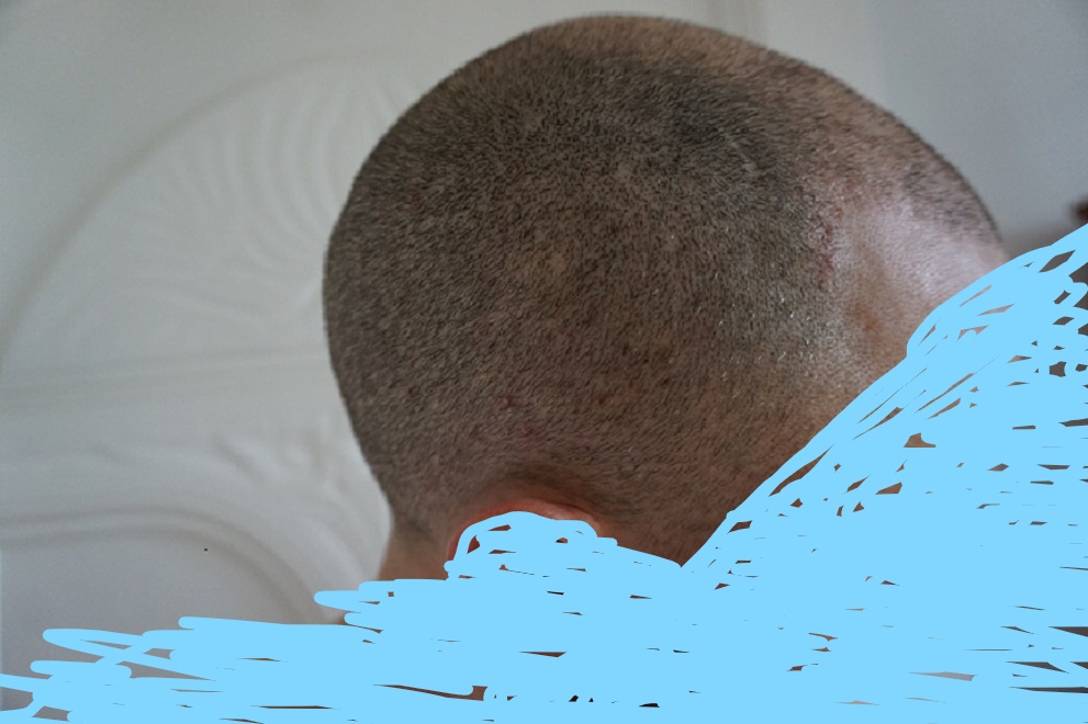 After one month 2.jpg