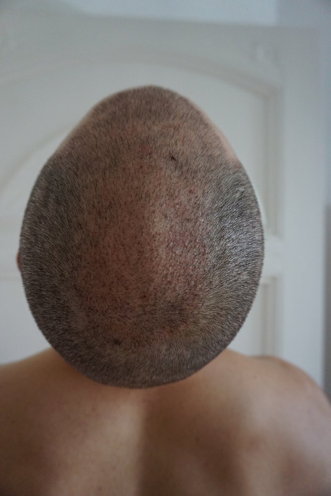 After one month 4.jpg