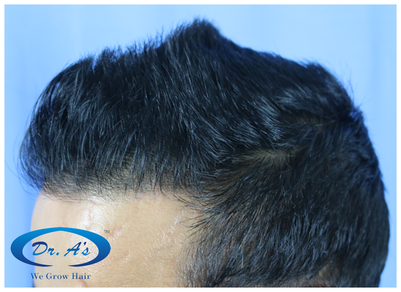 After picture 212_38.jpg