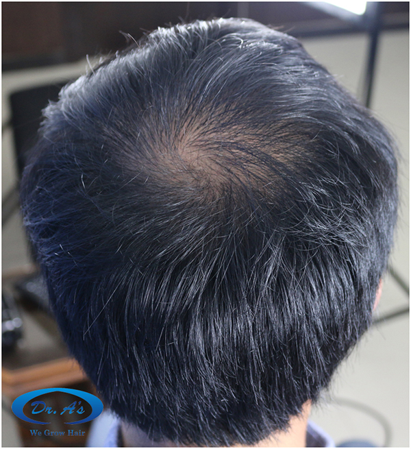 After picture crown picture.jpg
