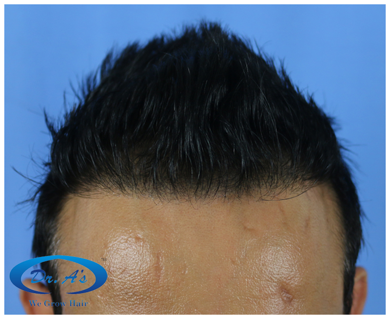 After picture12_18.jpg