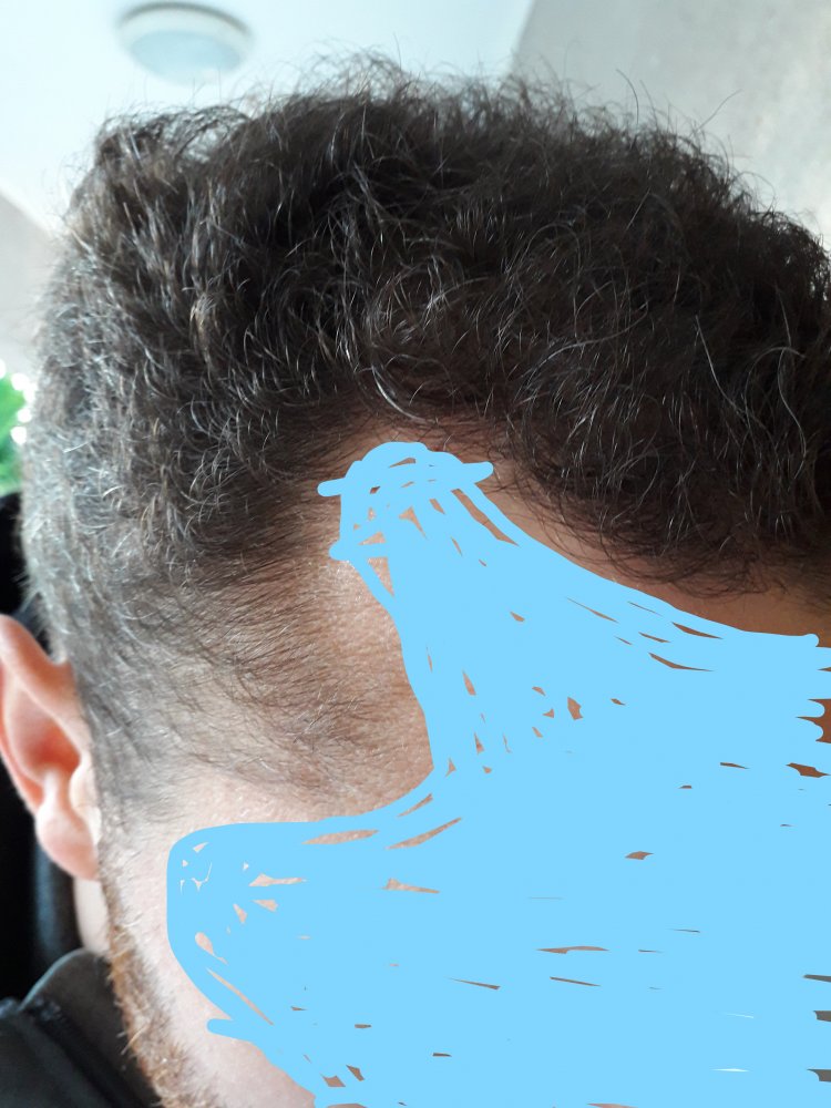 after Six Month 1.jpg