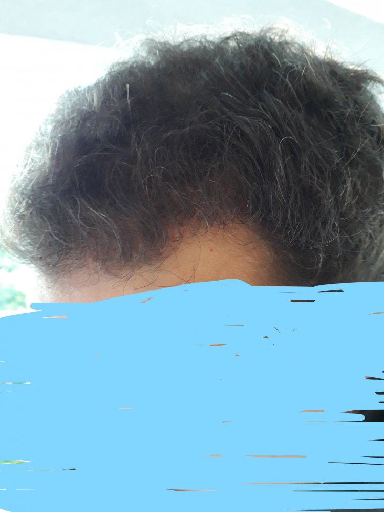 After Six Month 3.jpg