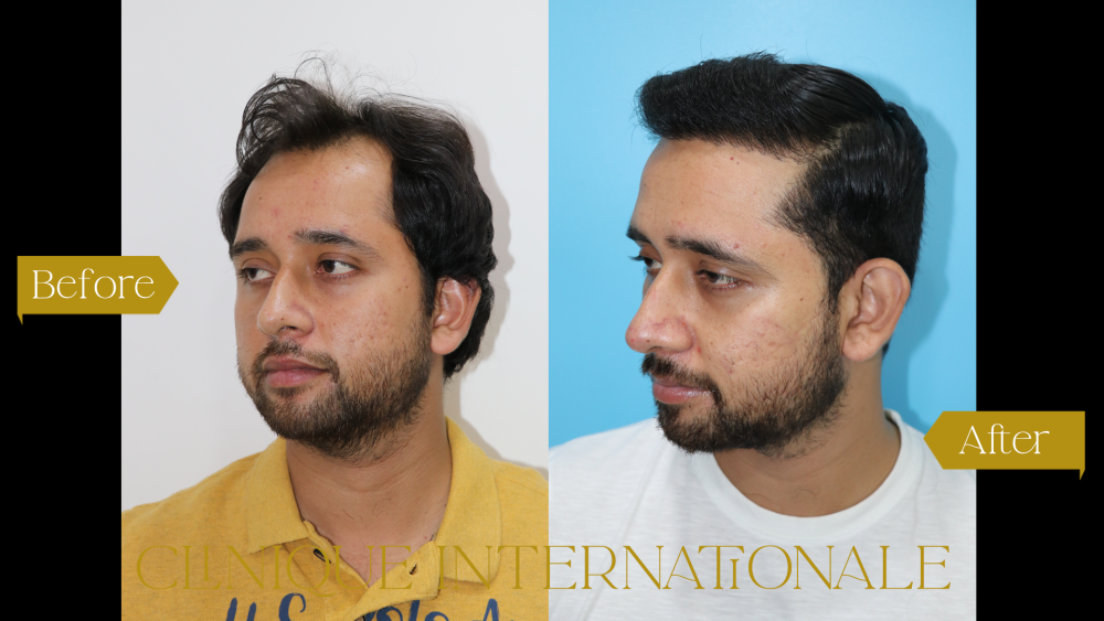 AKHIL-MAHAJAN (1).png