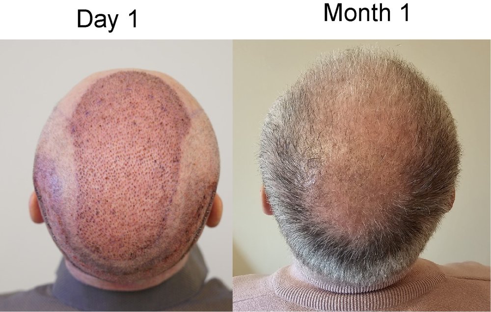 arial month 1.jpg