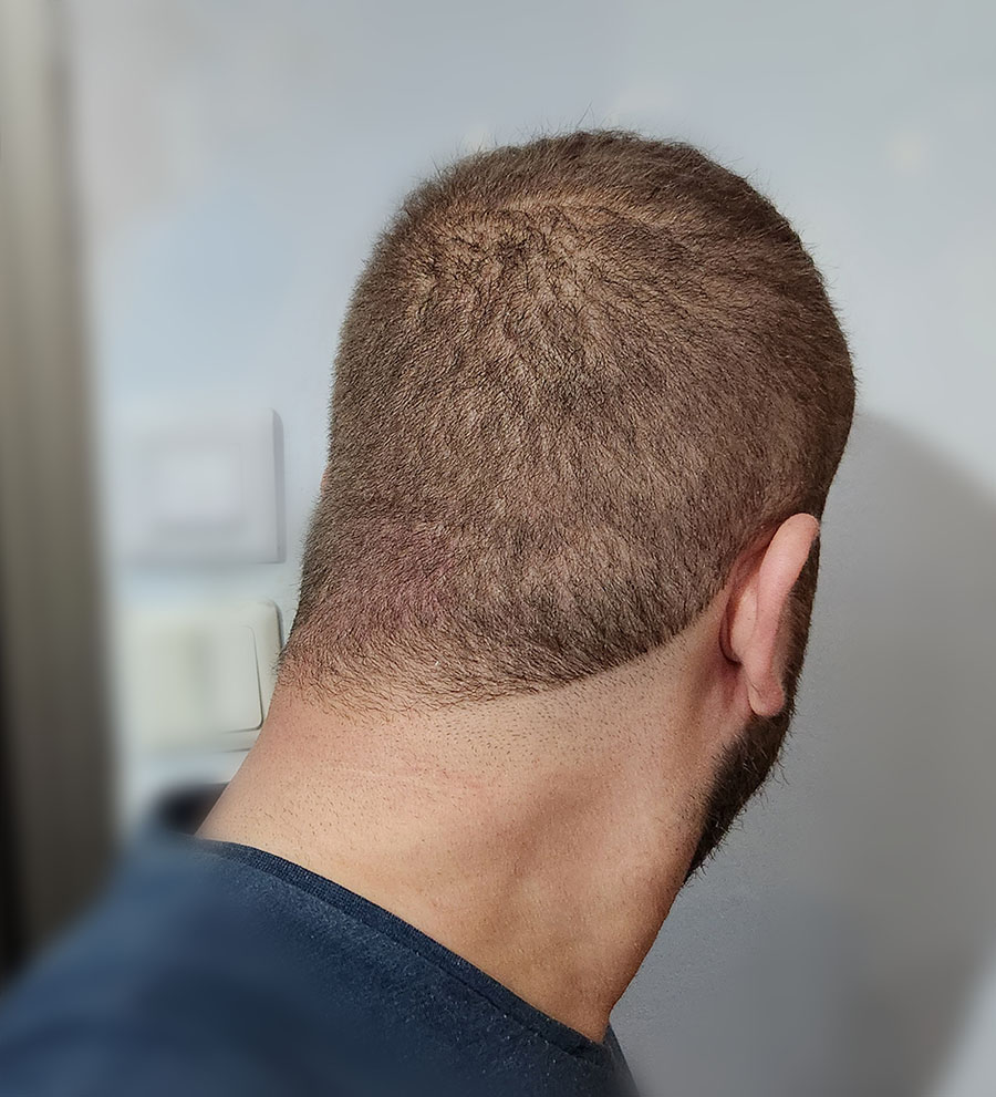 back-1-j.jpg