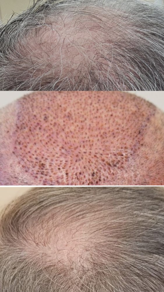 back comparison.jpg