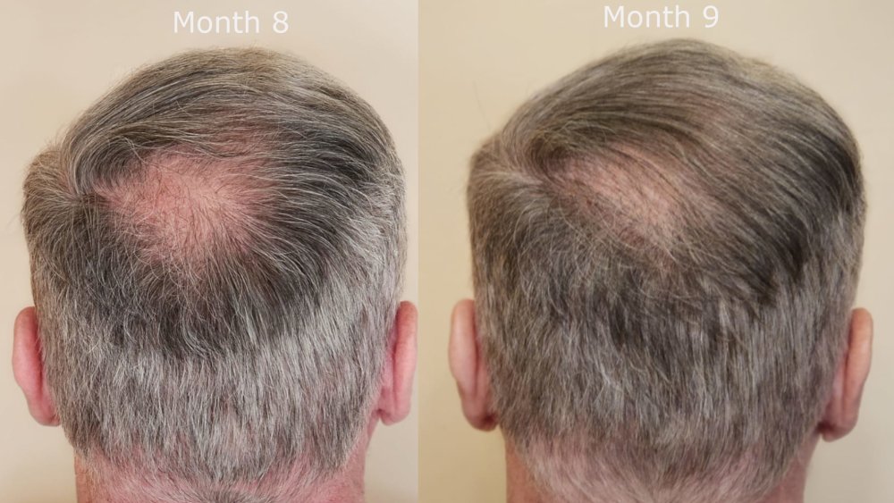 back month 8 v month 9.jpg
