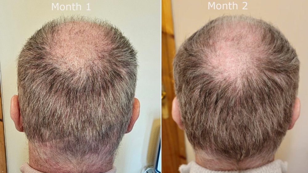 back month1 v month2.jpg