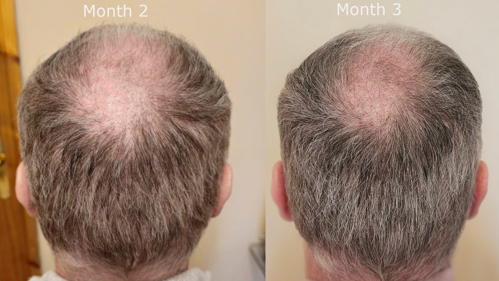 back month2 v month3.jpg