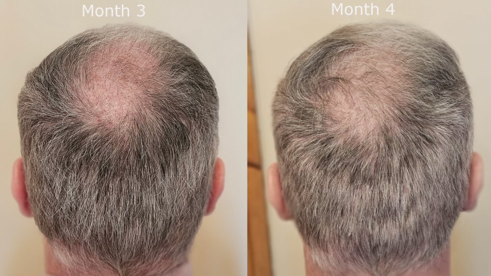 back month3 v month4.jpg