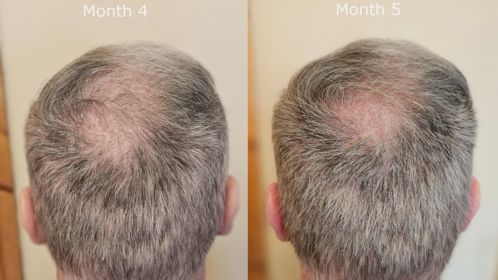 back month4 v month5.jpg