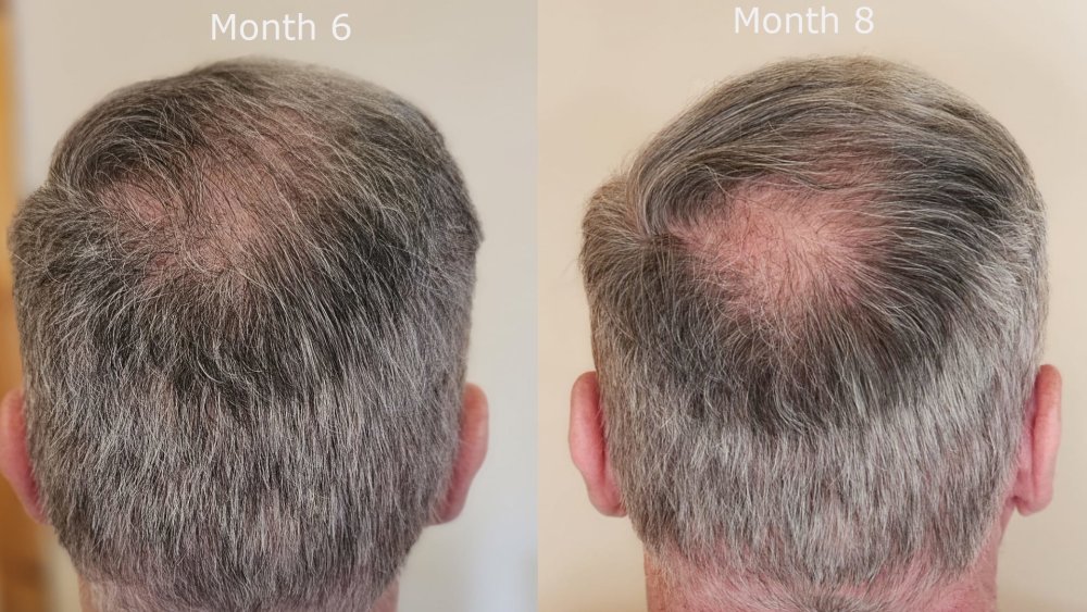 back month6 v month8.jpg