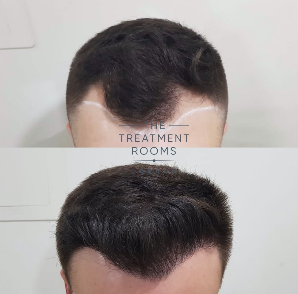 Before and after 1.jpg