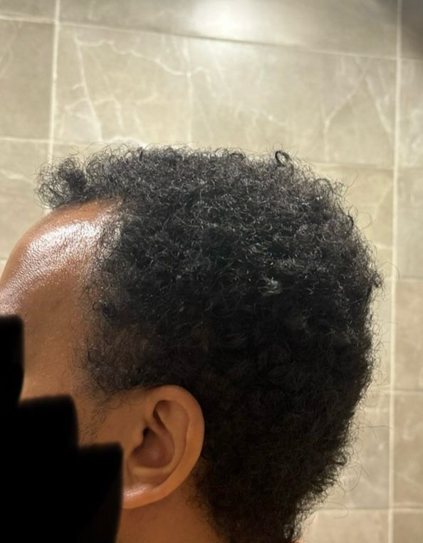 Before.jpeg