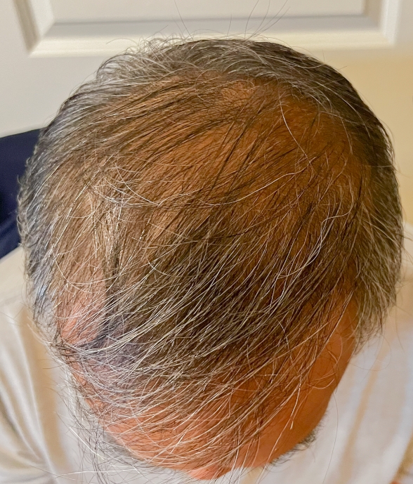 BEFORE.jpg