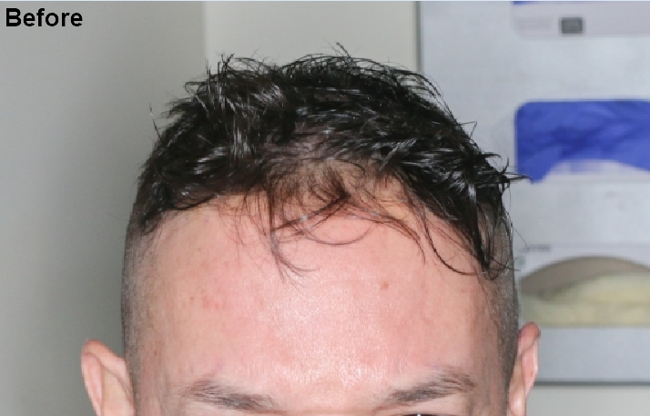 before.jpg