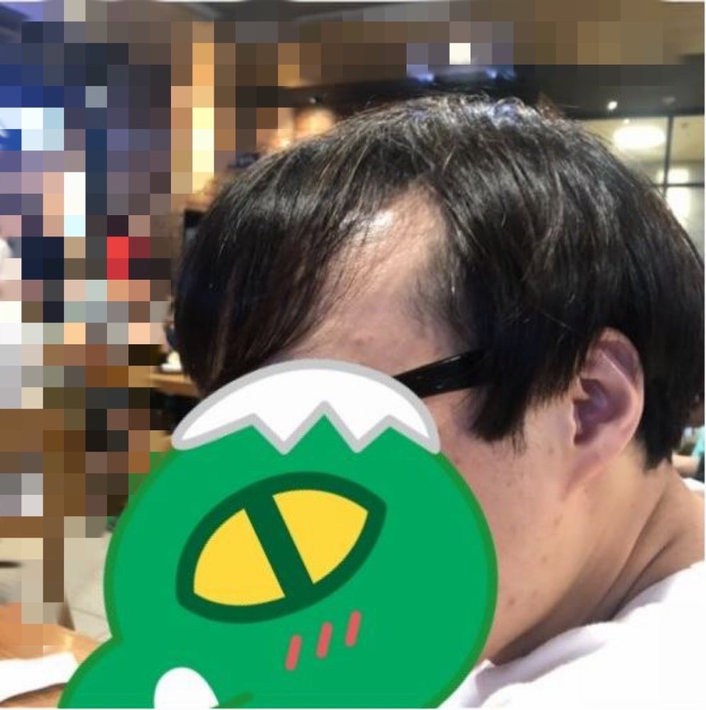 before.jpg