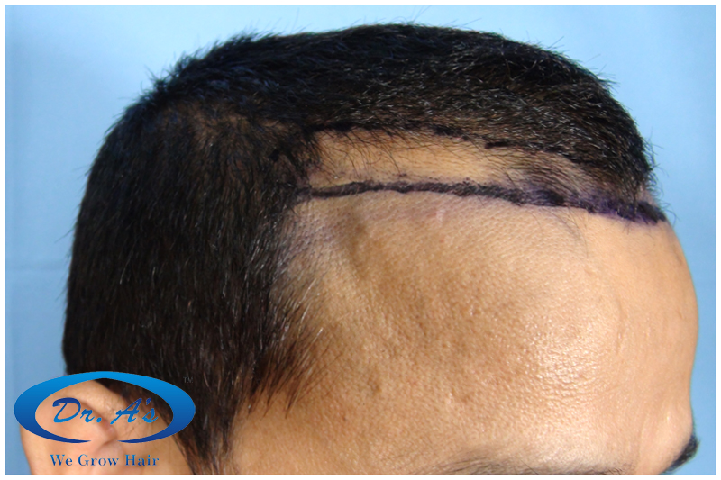 Before picture 211_32.jpg